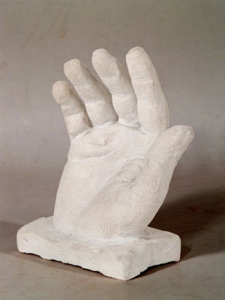 Hand Cast and Photos (from The Bandaged Poets Series)