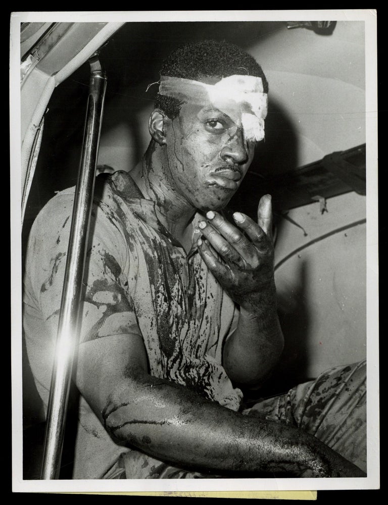 Item #629127 [Wire Photo]: "A bloodied man sits in ambulance after the second straight night of violence in the Negro section of New Jersey's largest city..."