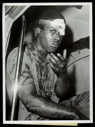 Item #629127 [Wire Photo]: "A bloodied man sits in ambulance after the second straight night...
