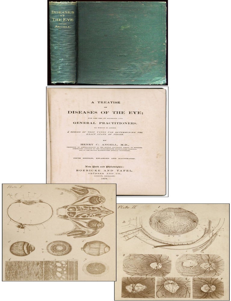 A Treatise on Diseases of the Eye: For the Use of General Practitioners, to which Is added a. Henry C. ANGELL.